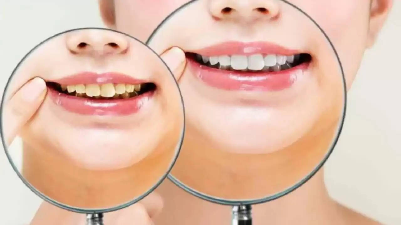 Daant ka Pilapan: रोज ब्रश करने के बाद भी क्या आपके दांत हैं पीले? ये रहा साफ करने का बेस्ट तरीका