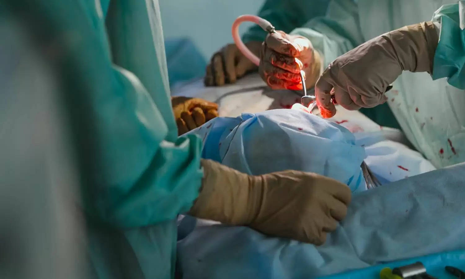 Uttarakhand Exclusive : हड्डी टूटकर घुसी दिमाग में, दून अस्पताल के न्यूरो सर्जरी विभाग के डाक्टर बने देवदूत 