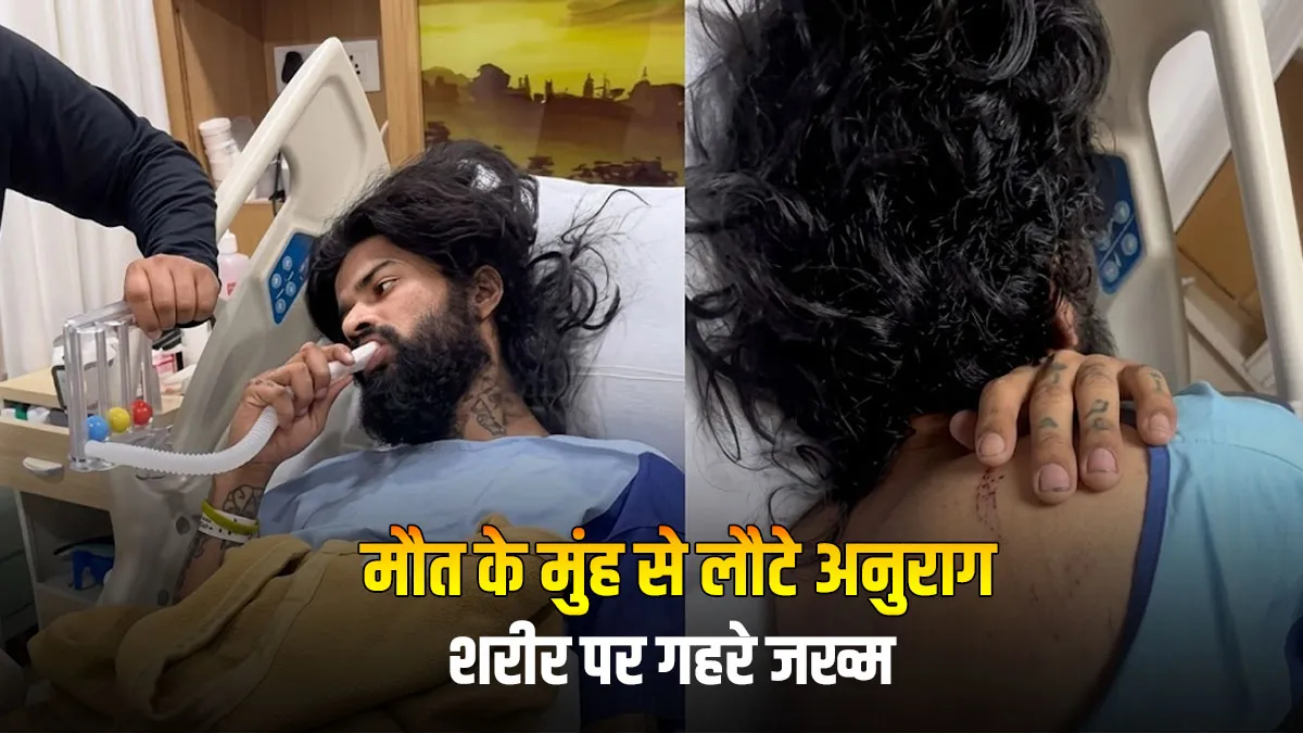 Anurag Dobhal Health Update: आईसीयू से बाहर आए 'UK07 राइडर', शरीर पर चोटों के निशान देख दहल गए फैंस