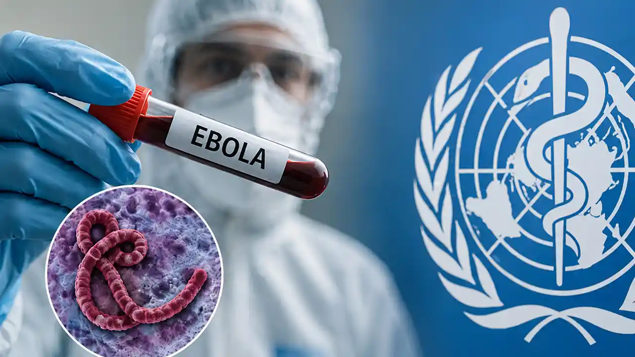 Ebola Virus : उत्तराखंड में इबोला वायरस को लेकर स्वास्थ्य विभाग ने जारी की विशेष एडवाइजरी, आप भी रहे अलर्ट